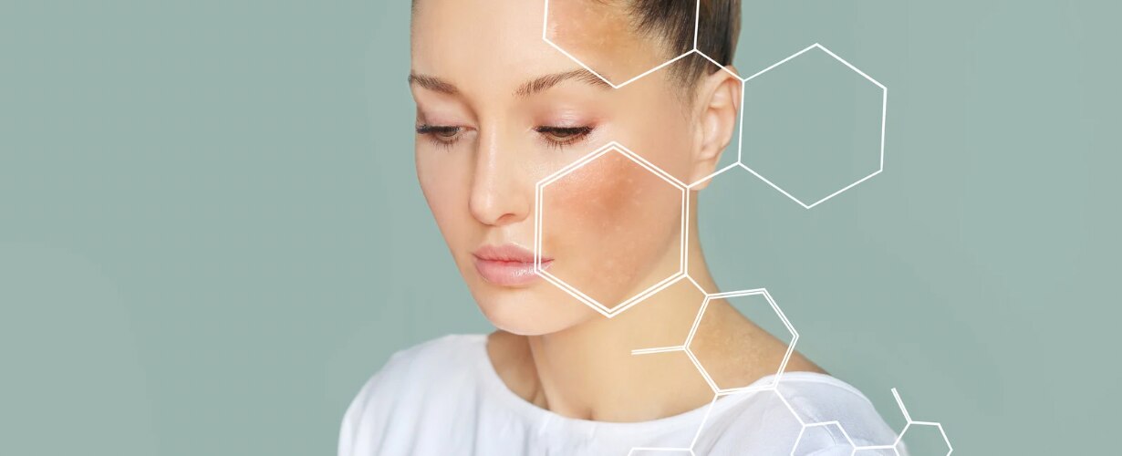 ¿Cuáles son los problemas en la piel provocados por el estrés?